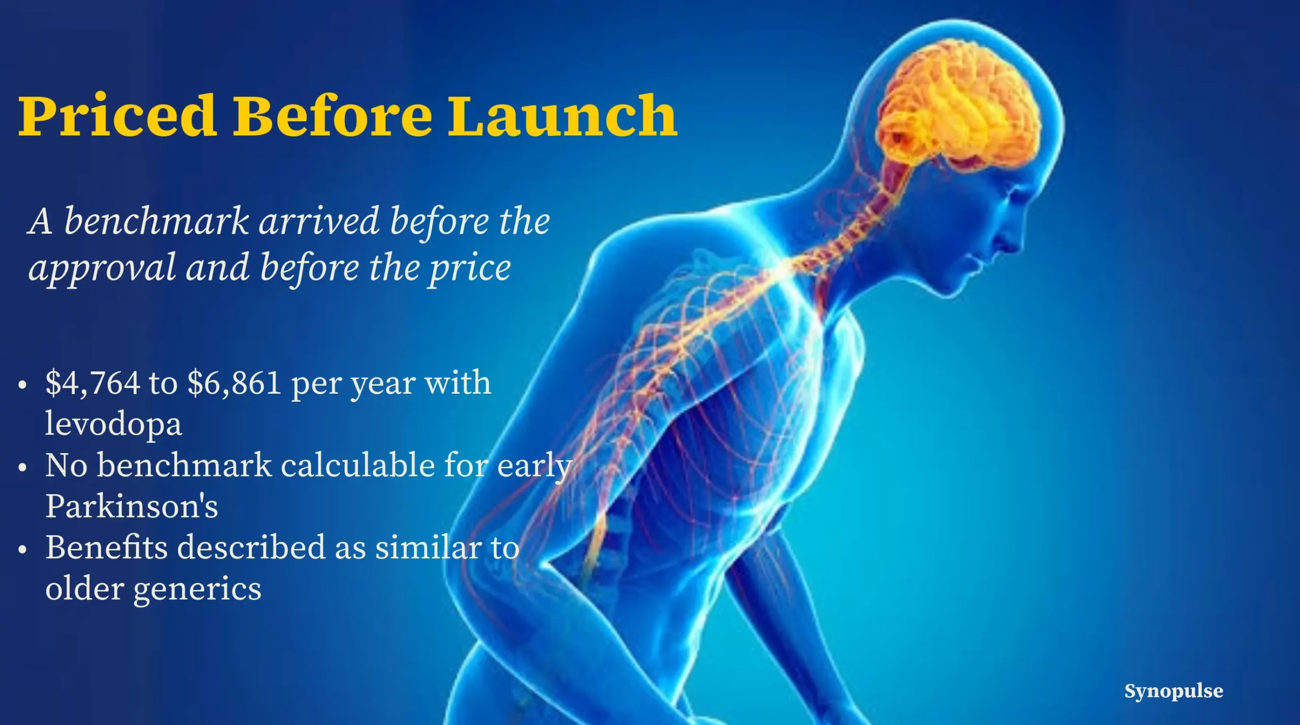 ICER Priced Tavapadon Before the FDA Approved It or AbbVie Named a Price