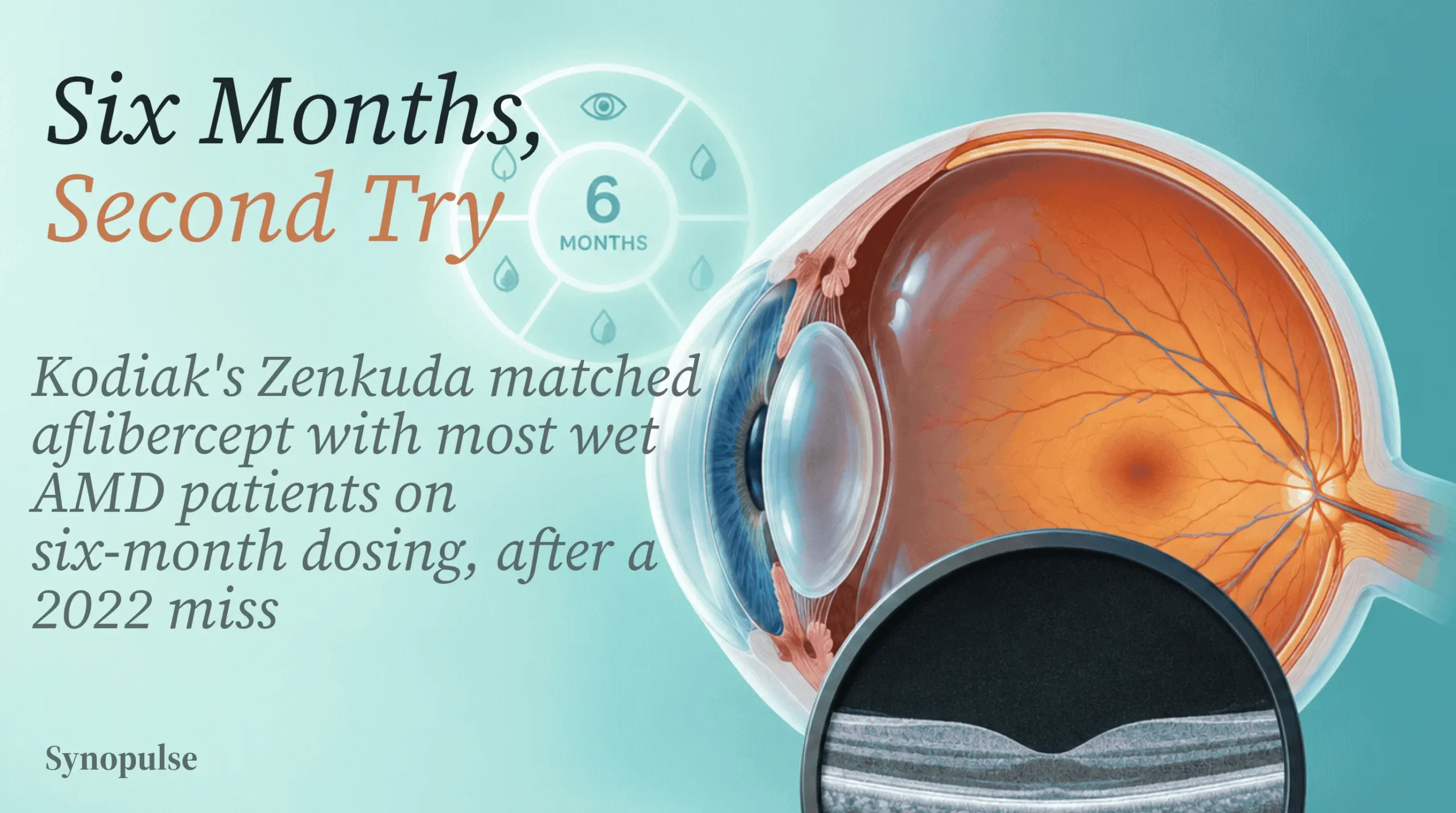 Kodiak's Zenkuda Put 54% of Wet AMD Patients on Six-Month Dosing, Four Years After an Extended-Dosing Miss